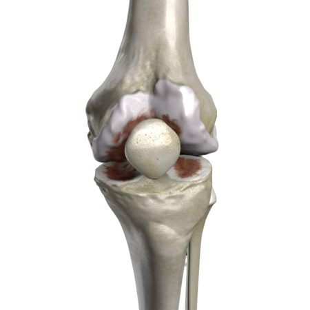 Healthy  Knee  Ii Preview