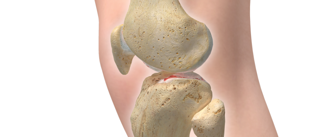 Knee Lateral Skeletal Arthritis Flat Copy